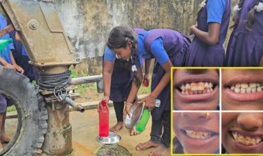 40 गांवों के स्कूलों में फ्लोराइड रिमूवल प्लांट बंद, 2 हजार बच्चों की सेहत पर मंडरा रहा खतरा, सुध लेने नहीं आ रहे जिम्मेदार