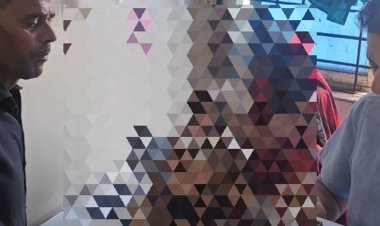 जलते कचरे के ढेर में गिरा 5 वर्षीय बच्चा:घर के बाहर खेलने के दौरान हुई घटना; मासूम का चेहरा जला, इंदौर रेफर