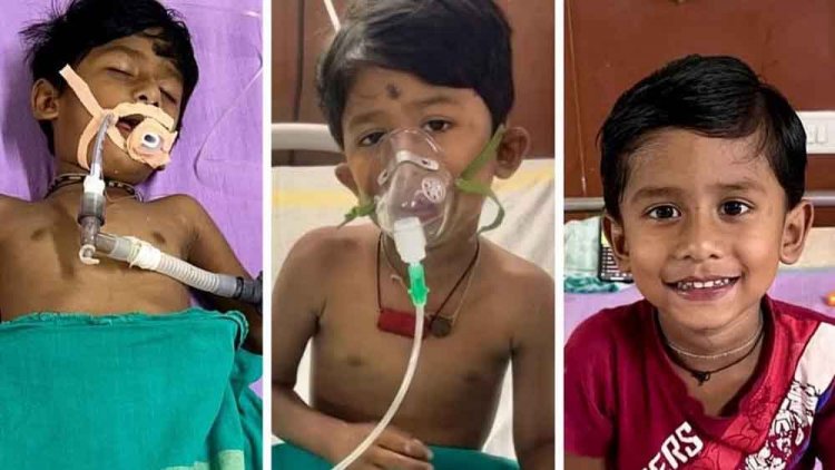 छत्तीसगढ़-रायगढ़ में करैत के डसने से मरणासन्न हुआ मानविक, डॉक्टरों ने बचाई जान