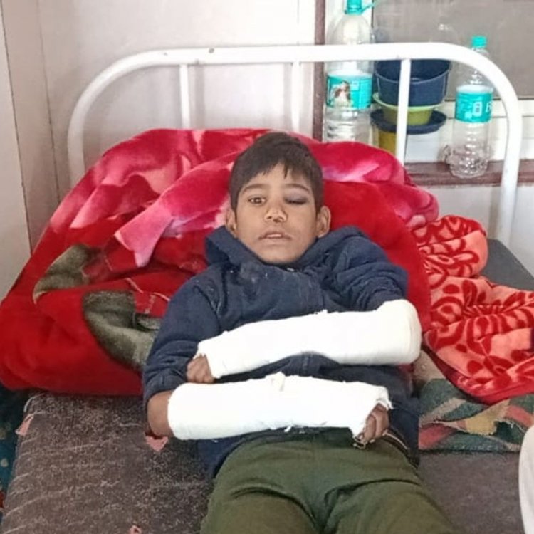 शिवपुरी में मकान की छत से नीचे गिरा बच्चा:पतंग उड़ाते समय बिगड़ा संतुलन, दोनों हाथों में फ्रैक्चर; इलाज जारी