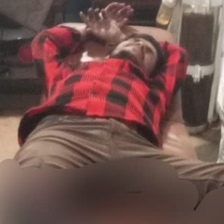 बतख चौराहे पर टैक्सी ने बाइक को टक्कर मारी:युवक का पैर तीन जगह से टूटा, झांसी मेडिकल कॉलेज रेफर