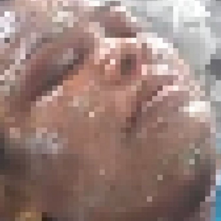 टिफिन सेंटर में प्रेशर कुकर फटने से महिला झुलसी:पुराने कुकर और गैस के इस्तेमाल से हुआ हादसा; चेहरा, हाथ और पेट जला